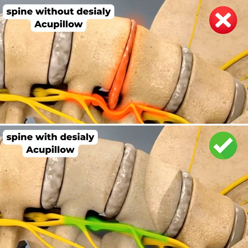 desialy™ 2-in-1 AcuPillow – Acupressure & Decompress